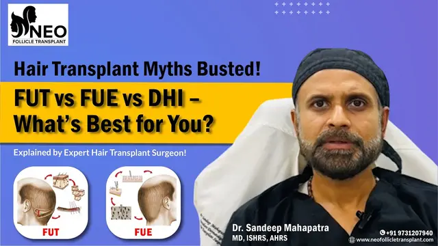 Hair Transplant Myths Busted | FUT vs FUE vs DHI Explained by Dr. Sandeep | Neo Follicle Hair Clinic