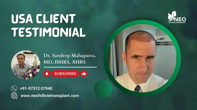 Hair transplant clinic | client testimonial | customer testimony | #hairtransplantresults