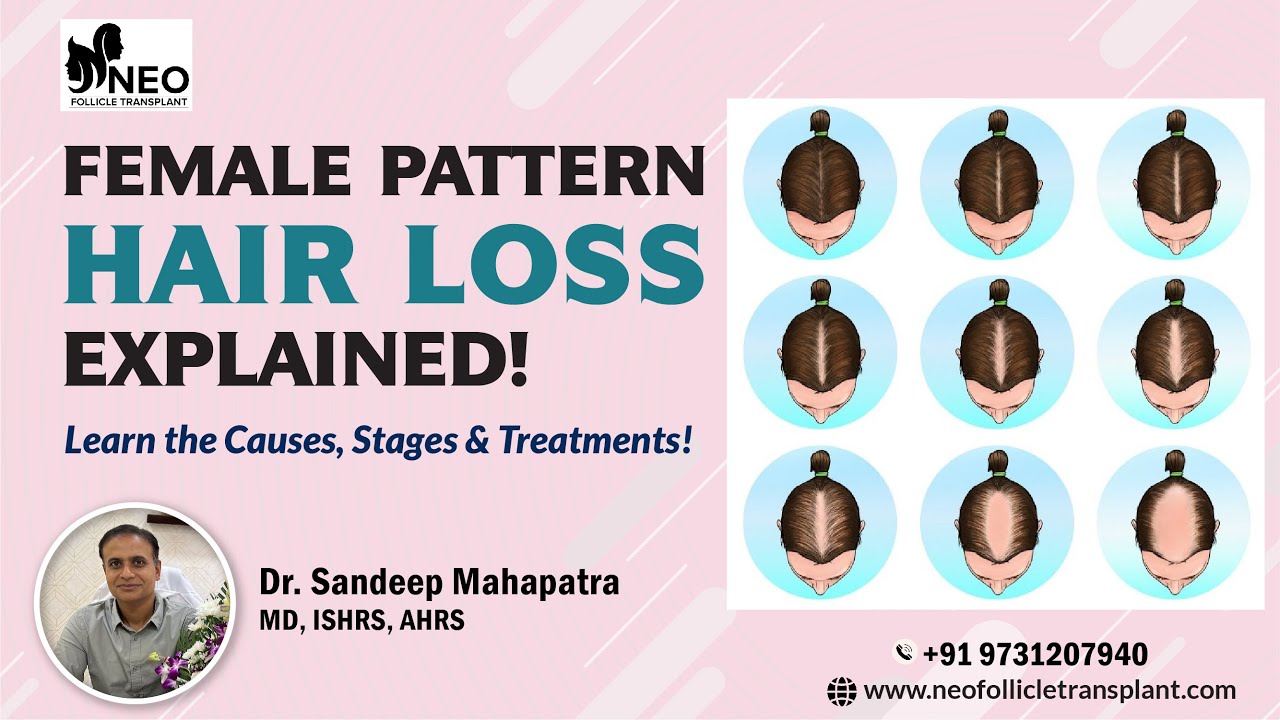 Understanding Female Pattern Hair Loss with Dr. Sandeep Mahapatra from Neo Follicle Hair Transplant.