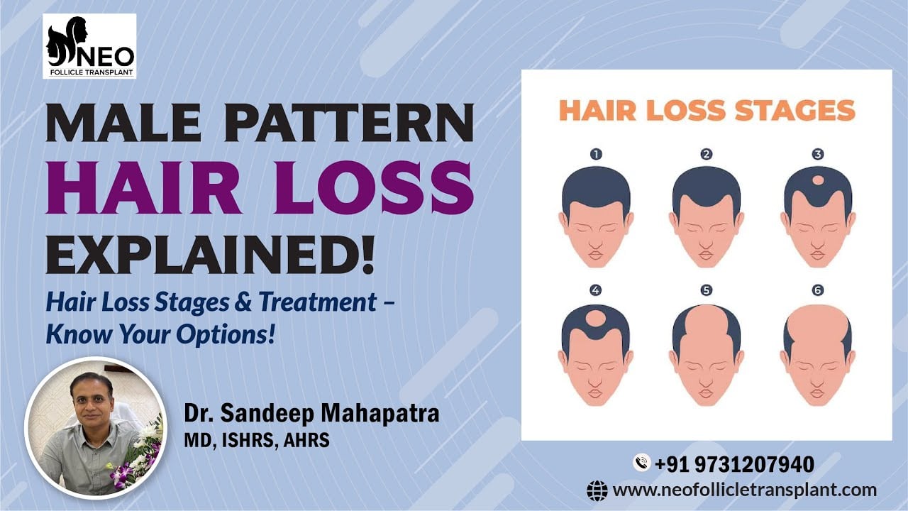 Understanding Male Pattern Hair Loss with Dr. Sandeep Mahapatra from Neo Follicle Hair transplant.
