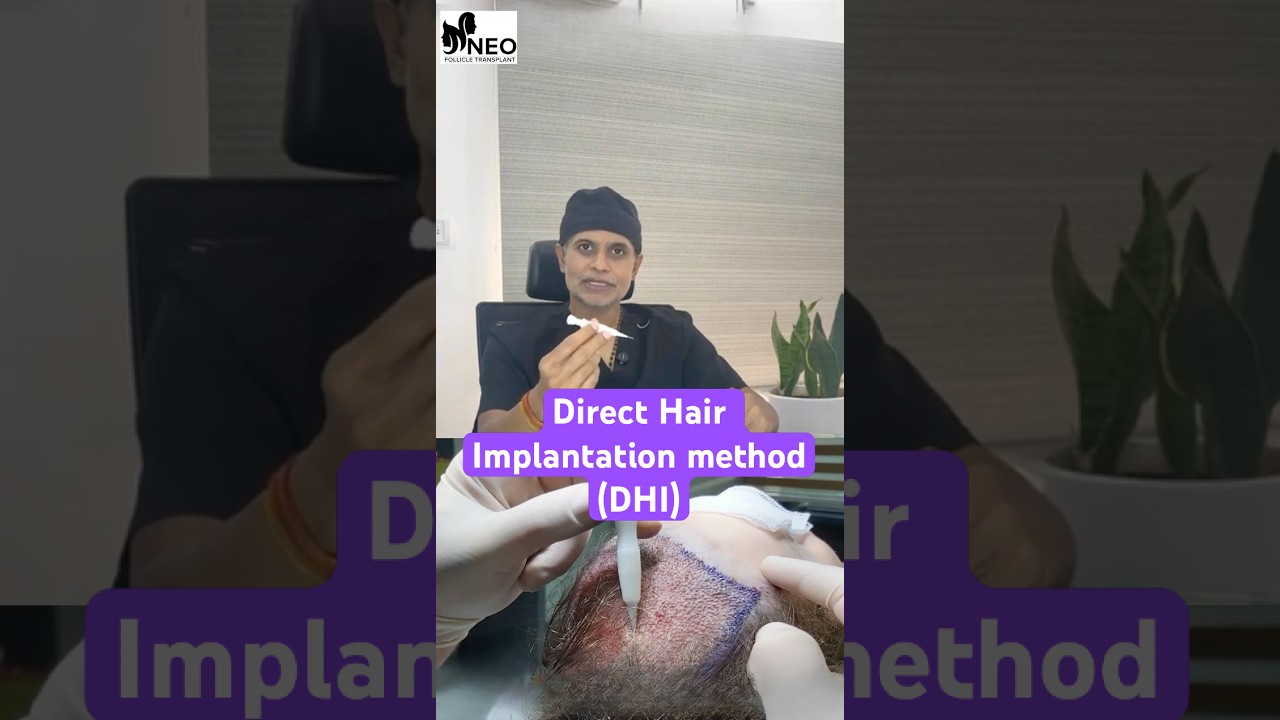 DHI Direct Hair Implantation Explained | Advanced Hair Transplant in Bangalore! #FUE #DHI #clinic