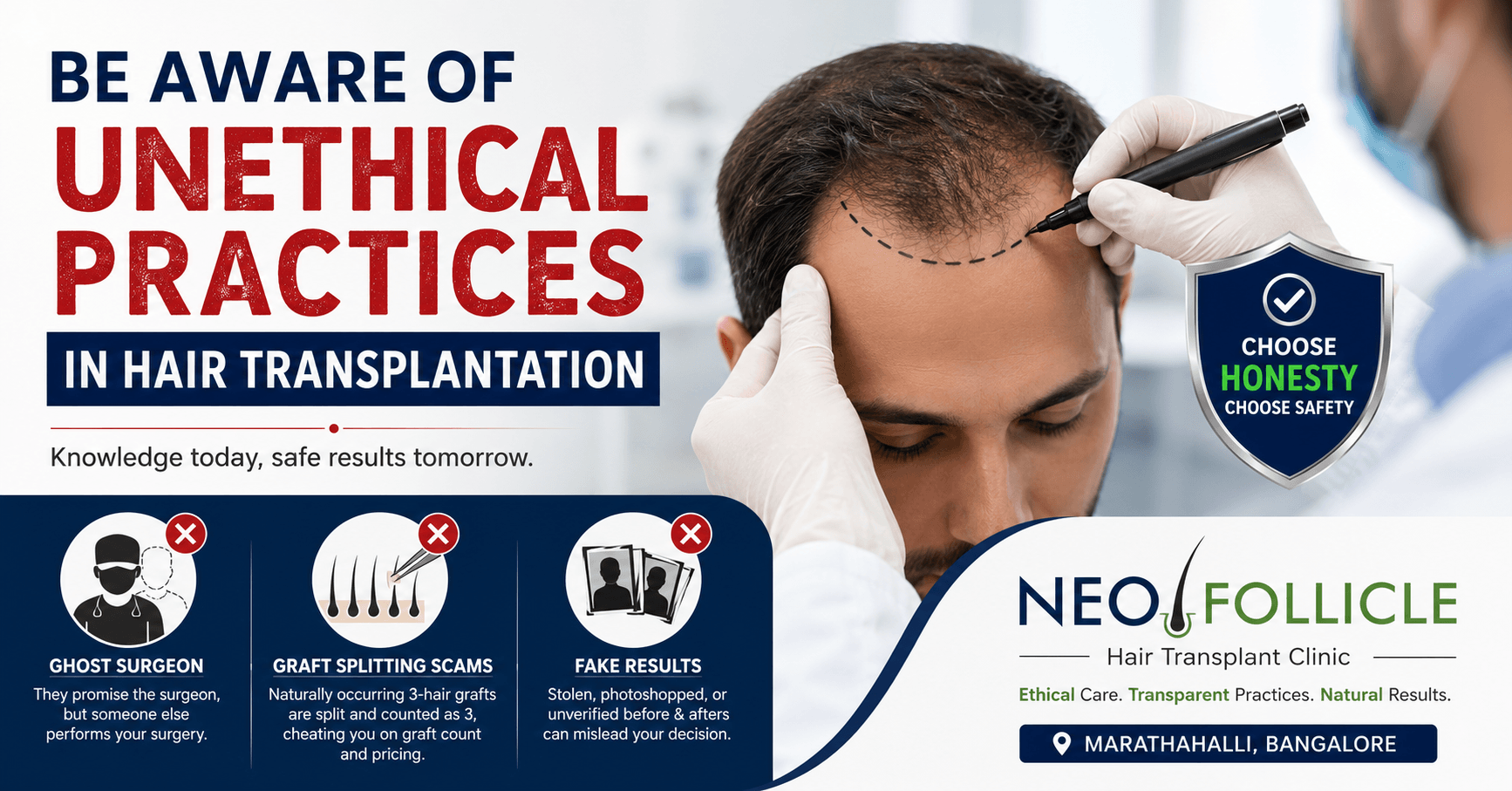 Unethical Practices in Hair Transplant